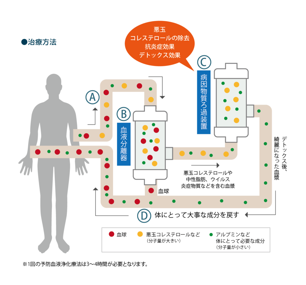 Diagram of the treatment: A, blood is drawn from the arm; B, a blood separator divides it into blood cells and plasma, and the plasma — containing LDL cholesterol, triglycerides, viruses and inflammatory substances — is sent to C, the disease-substance filtration device, for LDL removal, anti-inflammatory and detoxifying effects; D, the components the body needs are returned along with the blood cells
